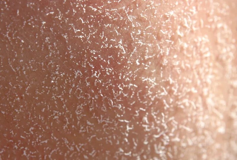 Выступает соль. The act скраб кокос. Высолы (белый кристаллический налёт). Соль выступает на коже. Происхождение слова соль.