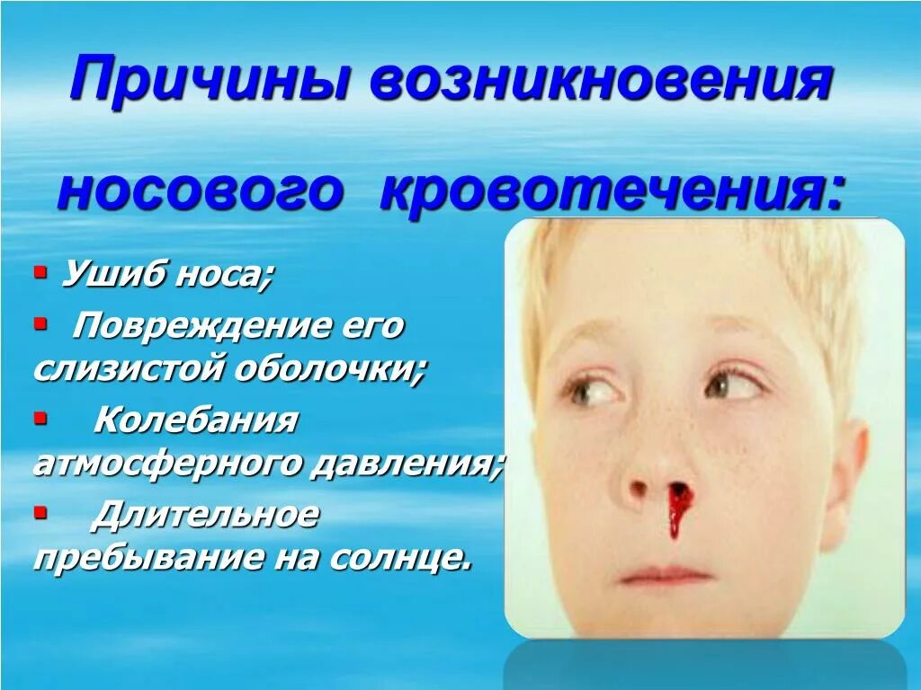 Причины носового кровотечения. Причины кровотечения из носа. Почему идёт кровь из носа.