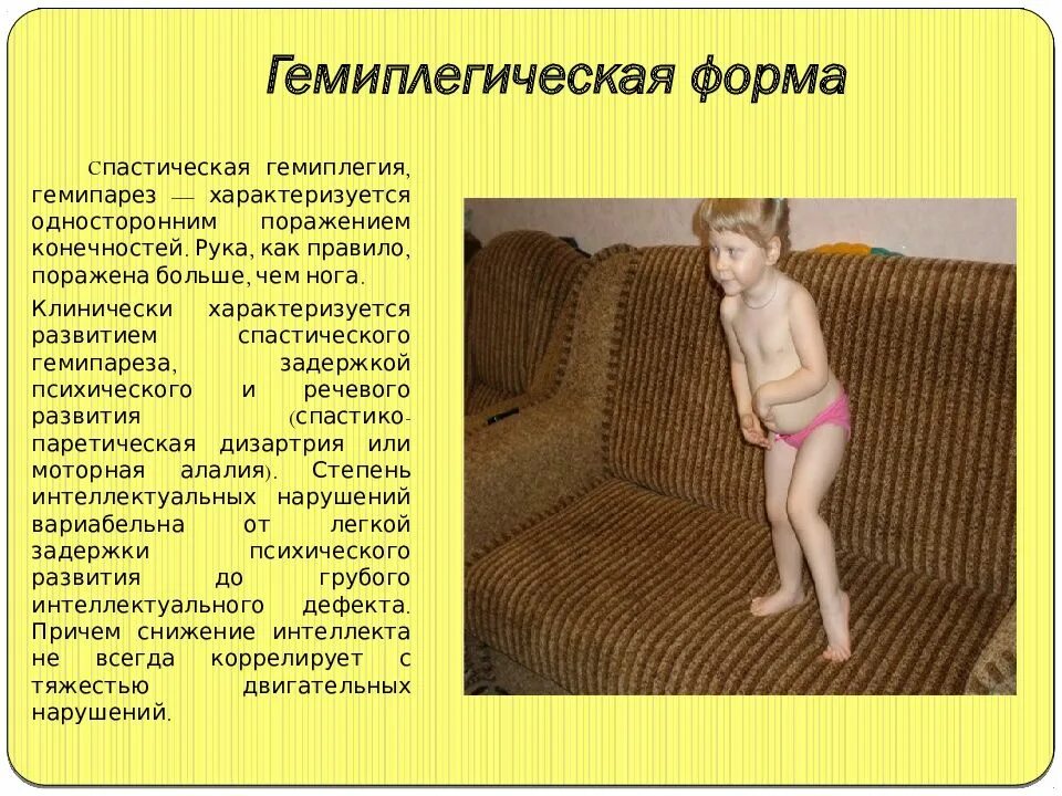 Гемиплегия симптомы. Дцп спастический гемипарез. гемиплегическая форма дцп. дцп правосторонний гемипарез. спастическая гемиплегия дцп.
