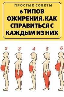 Глютеновое ожирение у женщин что это