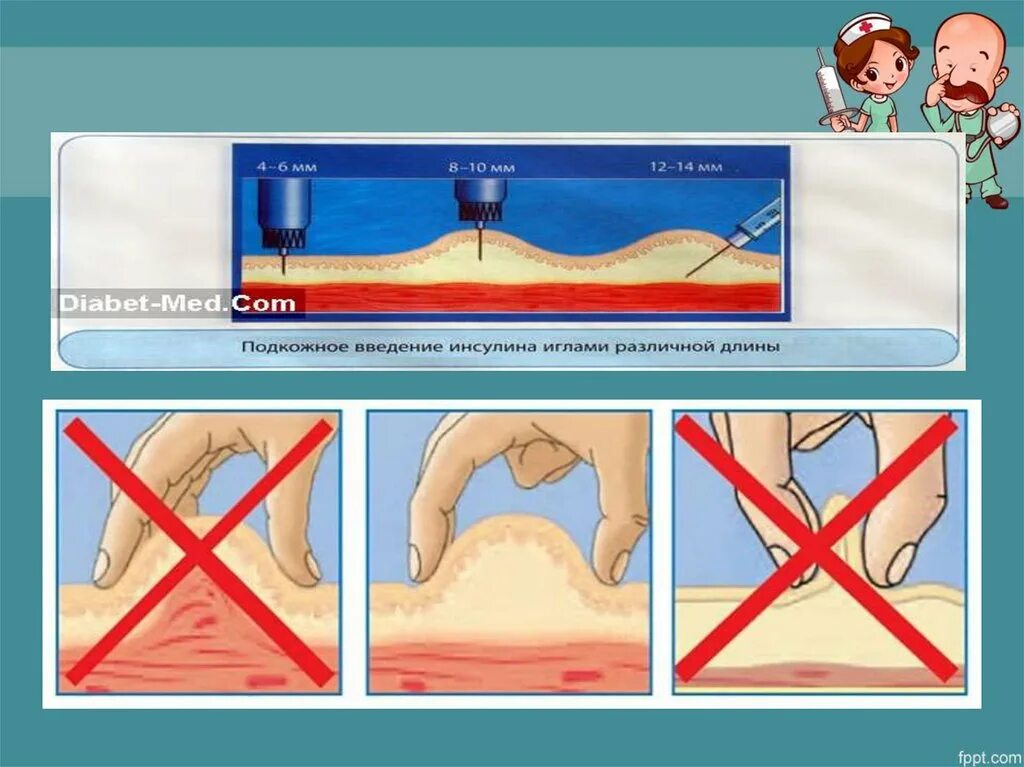 Подкожная глубина введения иглы. Подкожное Введение. Введение лекарства подкожно. Проведение подкожной инъекции алгоритм. Подкожное Введение алгоритм.