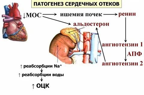 Проявление сердечных отеков