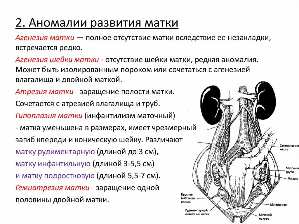 Аномалии развития матки классификация. Пороки развития маточных труб.