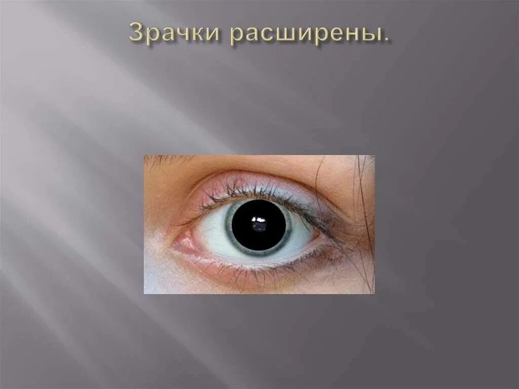 Расширение зрачков на свет. Большие зрачки. Расширенный зрачок у подростка. Расширенные зрачки причины.