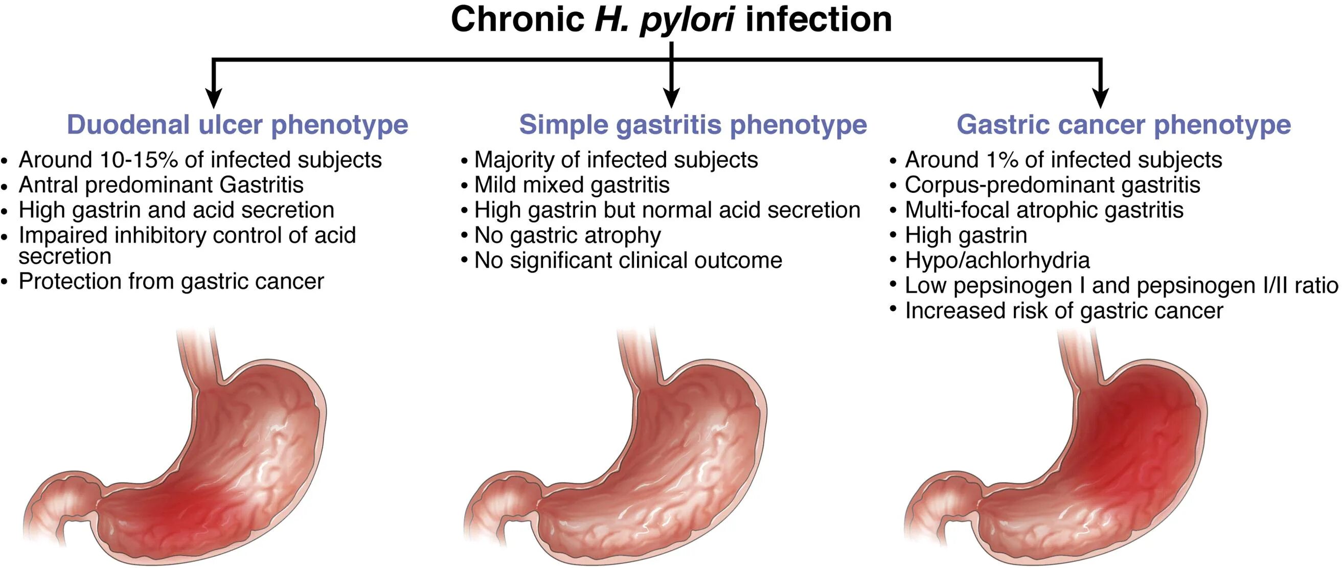 Хеликобактер язык. Helicobacter pylori (h. pylori) — грамотрицательная,. Helicobacter анемия. Кислотозависимые заболевания h pylori.