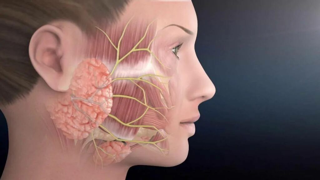 Лицевой нерв челюсти. Опухоль околоушной слюнной железы. Шишка в околоушной слюнной железы. Онкология околоушная слюнная железа. Околоушная слюнная железа 3д.