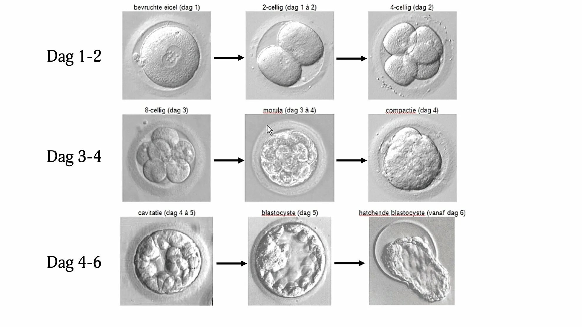 Сколько эмбрионов форум. Зигота морула бластоциста. Бластула морула бластоциста. Эко эмбрион морула. Бластоциста морула эмбрион.