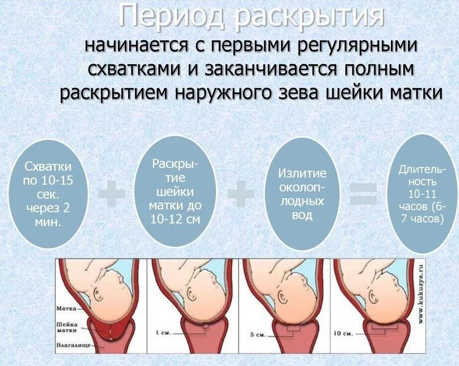 Периоды родов раскрытие. Период раскрытия шейки матки. Первый период родов раскрытие. Какие признаки скоро роды