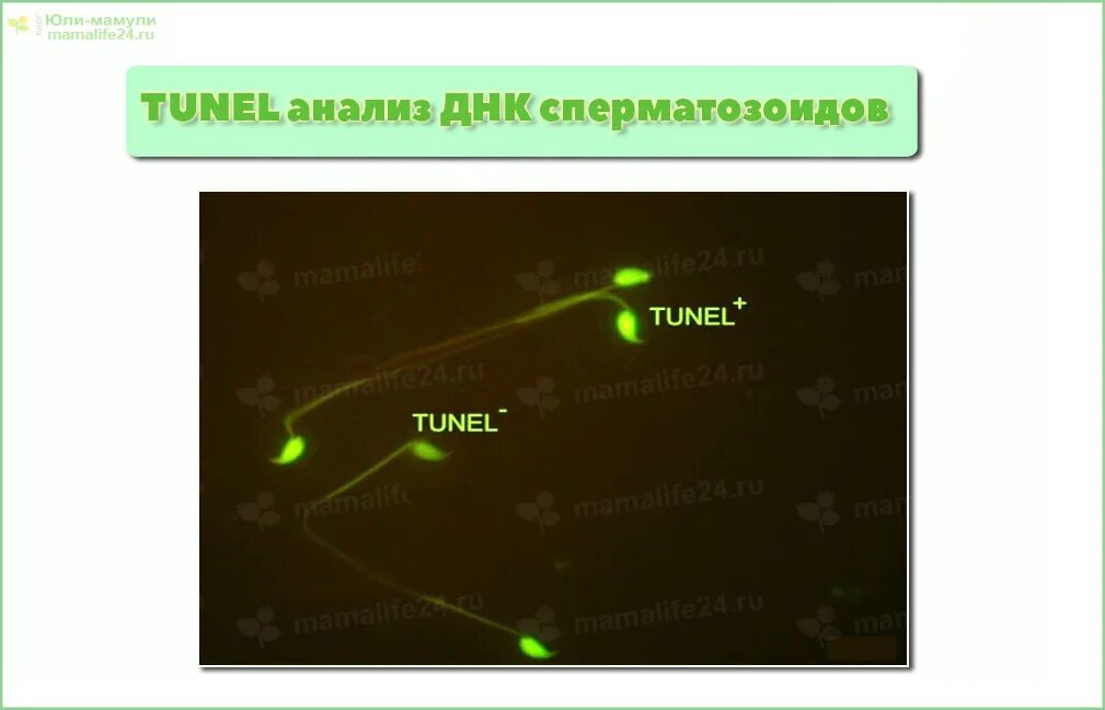 Днк методом tunel. Фрагментация ДНК методом tunel. Tunel тест. Фрагментация ДНК сперматозоидов tunel. ДНК фрагментация туннель.