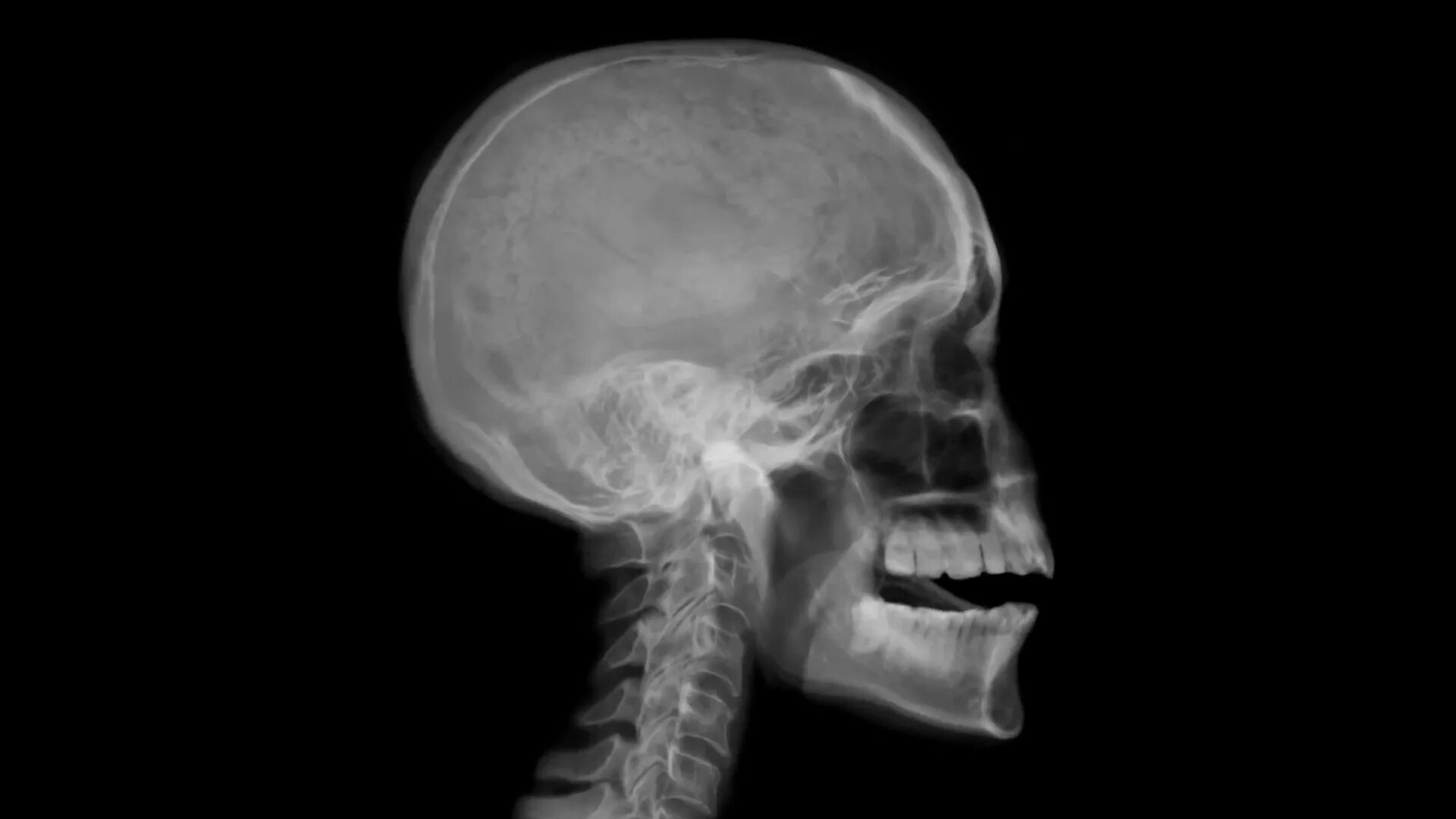 3d head model bust. 3dscanstore. X head. X head. Рентгеновские снимки черепа.