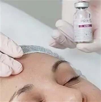 Как делают пилинг prx. Prx. prx t33 пилинг эстетика.