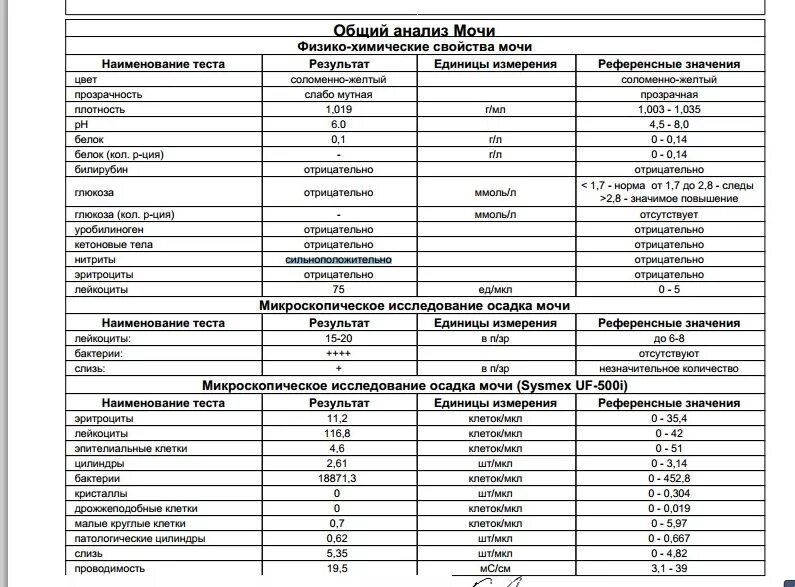 Анализ мочи у мужчин лейкоциты. Исследование мочи микроскопия осадка нормы. Микроскопия осадка мочи лейкоциты норма у детей. Микроскопическое исследование мочи норма у детей. Микроскопия мочи норма.