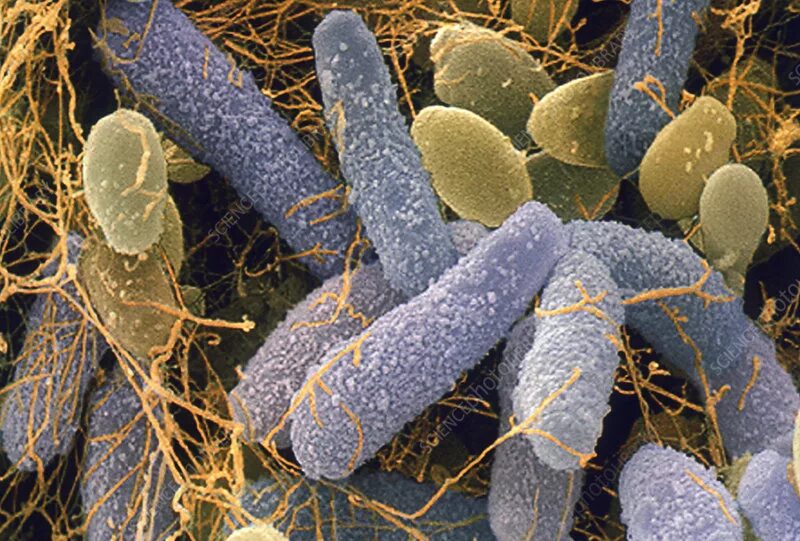 Уксусно кислые бактерии. Уксуснокислые бактерии acetobacter. acetobacter xylinum. gluconobacter и acetobacter. acetobacter pasteurianus.