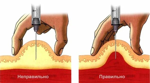Резко начинает колоть