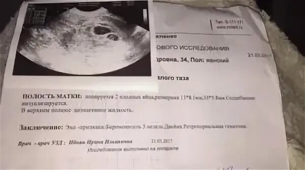 Может врач ошибиться с полом ребенка
