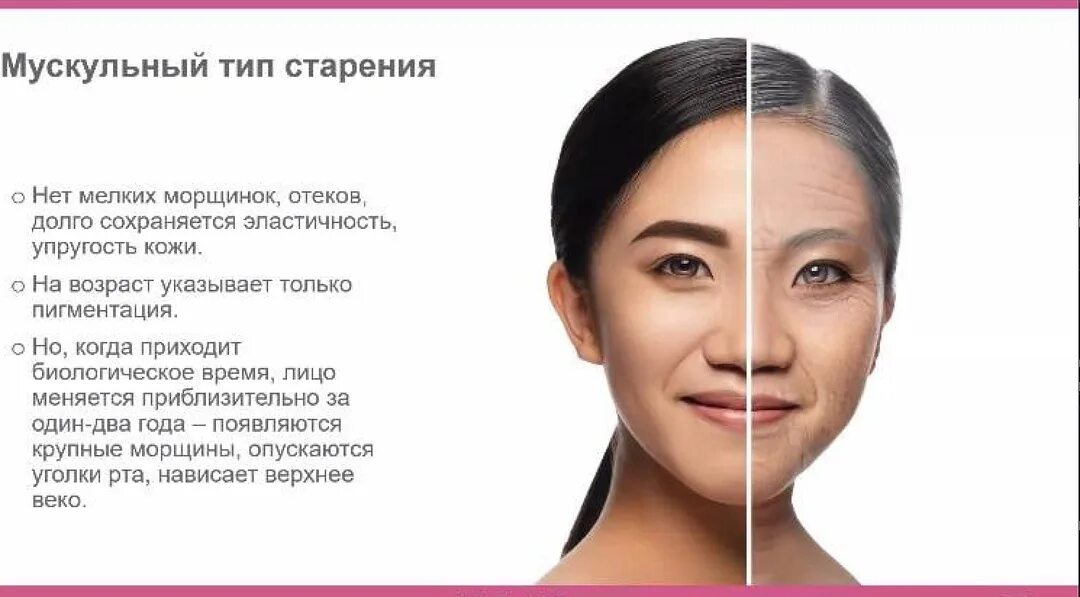 Тип старения примеры. Мускульный тип старения. мышечный имп старения. мелкоморщинистый тип старения кожи. азиатский тип старения.