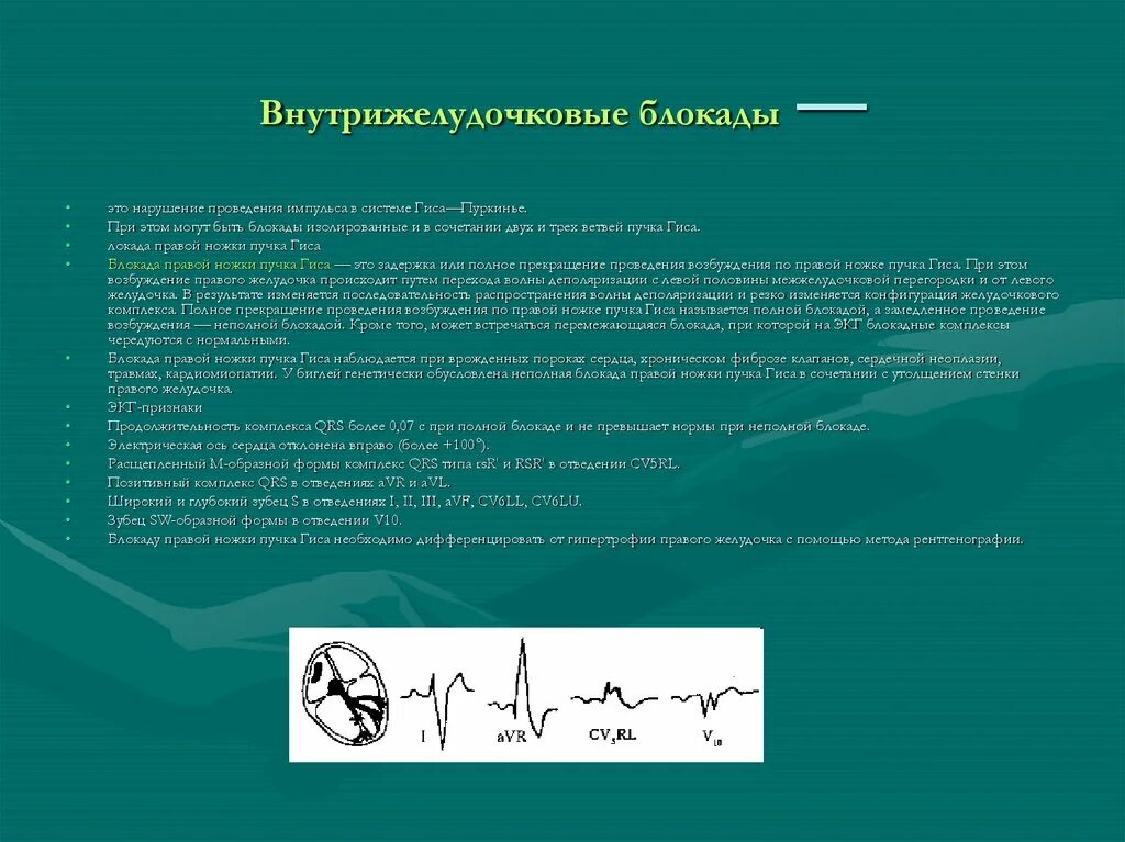 Клиника при полной блокаде правой ножки пучка Гиса. Блокада ножки пучка Гиса клиника. Неполная блокада правой ножки пучка Гиса причины. Неполная блокада правой ножки пучка Гиса причины возникновения. Блокада правой ножки желудочка