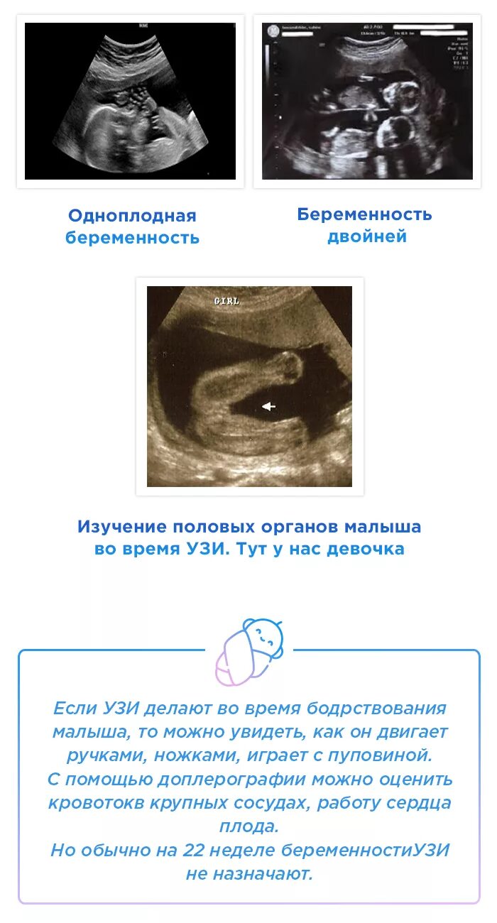 Положение плода на 22 неделе беременности. Малыш на 22 неделе беременности УЗИ. Можно ли на 22 неделе