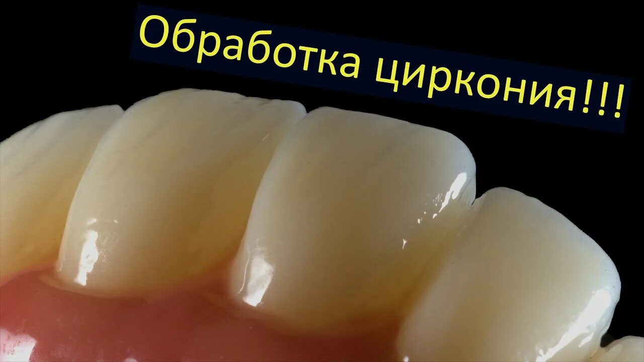 Циркониевая коронка видео. Циркониевые коронки до и после. Диоксид циркония коронки улыбка. Коронки диоксид циркония а1. Виниры диоксид циркония.