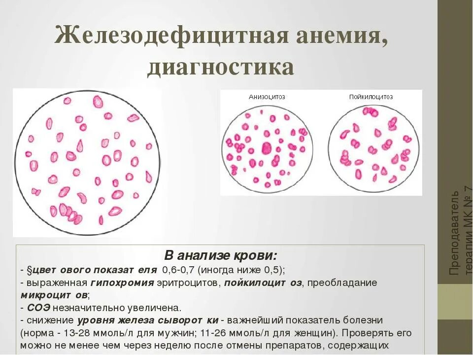 При железодефицитной анемии в анализе крови наблюдаются. Железодефицитная анемия кровь. Картина крови при железодефицитной анемии. Железодефицитная анемия анализ крови показатели.