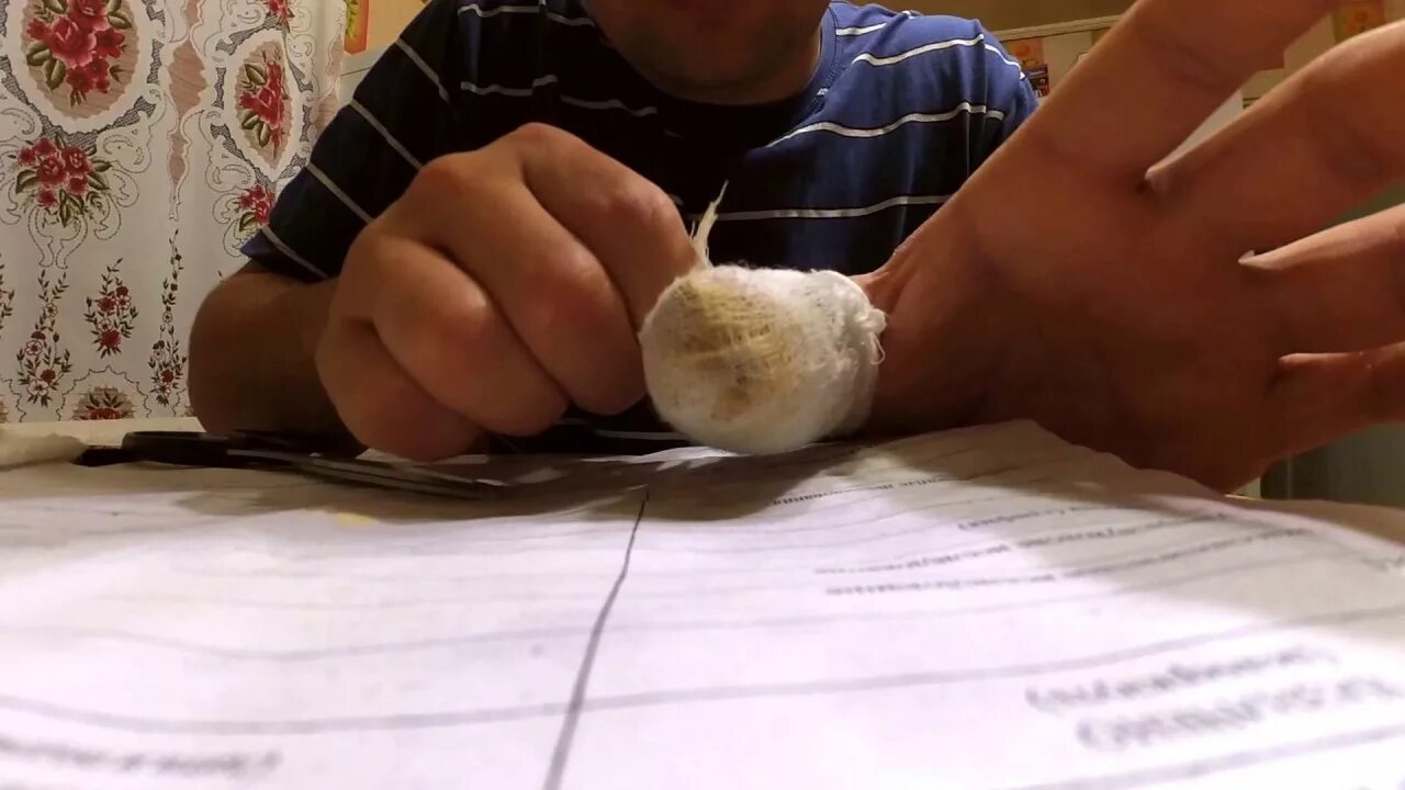 Рубят палец