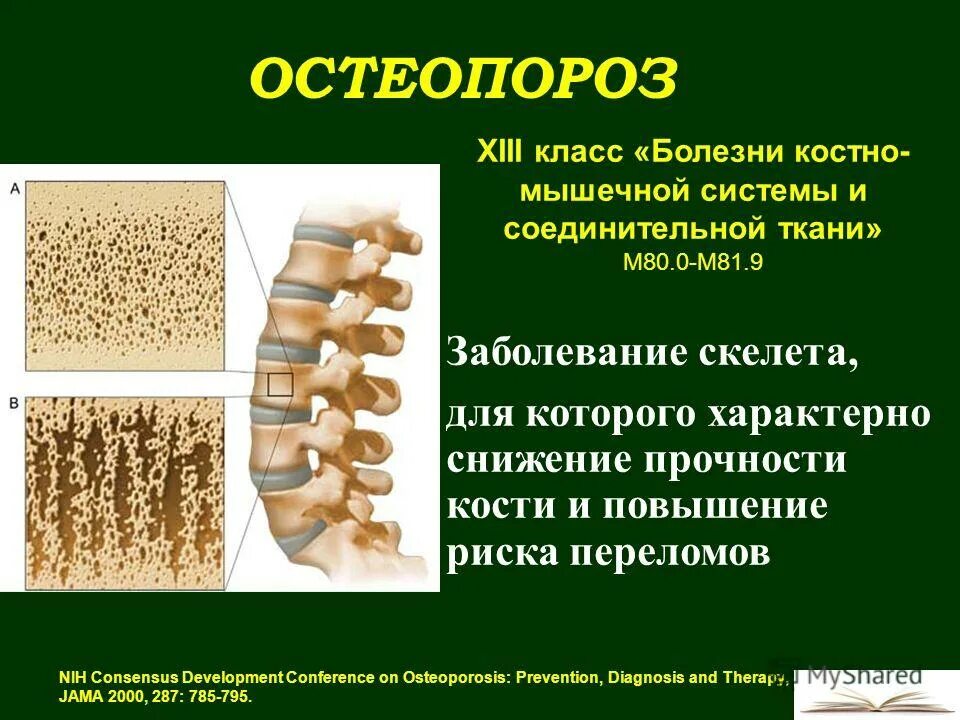 заболевания костно-мышечной системы. опорно двигательная система мышцы. костно мышечная система и соединительные ткани. костно мышечная система и соединительные ткани. системы заболевания соединительной ткани мкб-10.