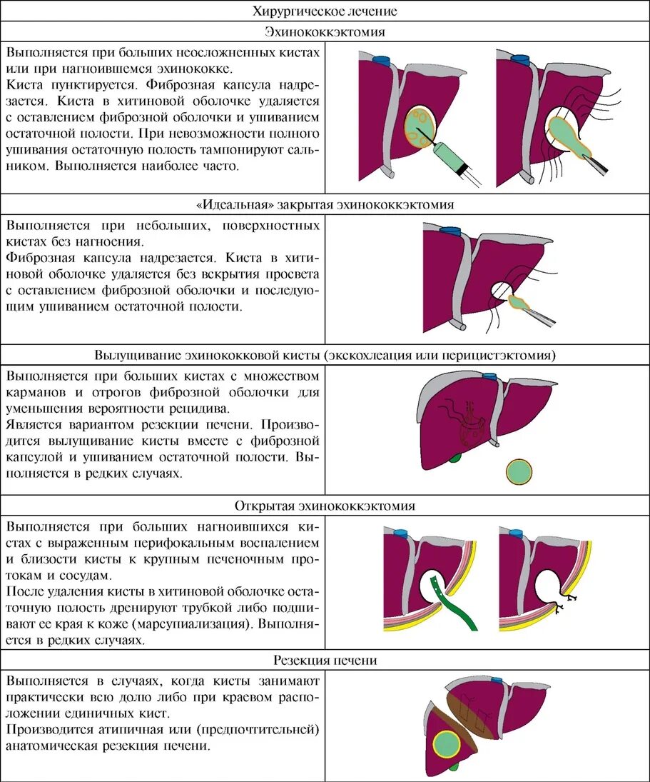 Операция резекция печени. Эхинококкэктомия печени операция. Схема поражения печени альвеококкоз. Эхинококкэктомия ход операции. Операции при эхинококкозе печени.