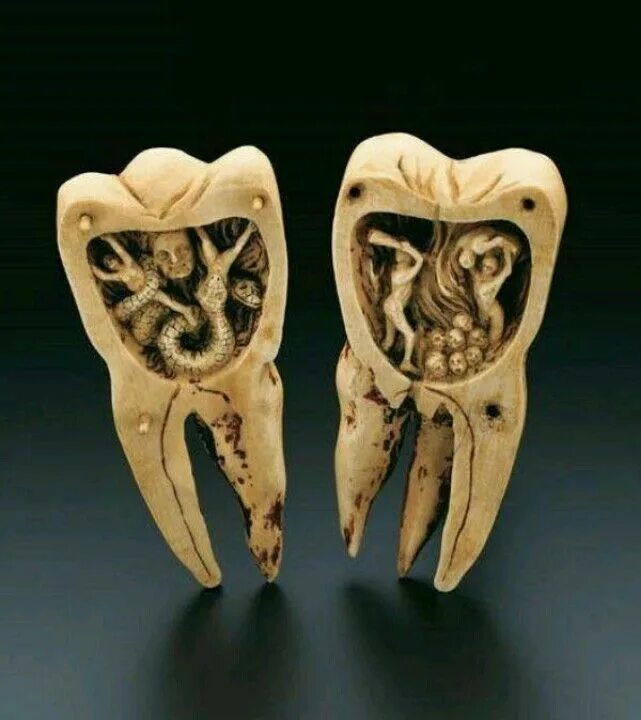 Pin on Demonstration Dental, Dental world, Dental problems