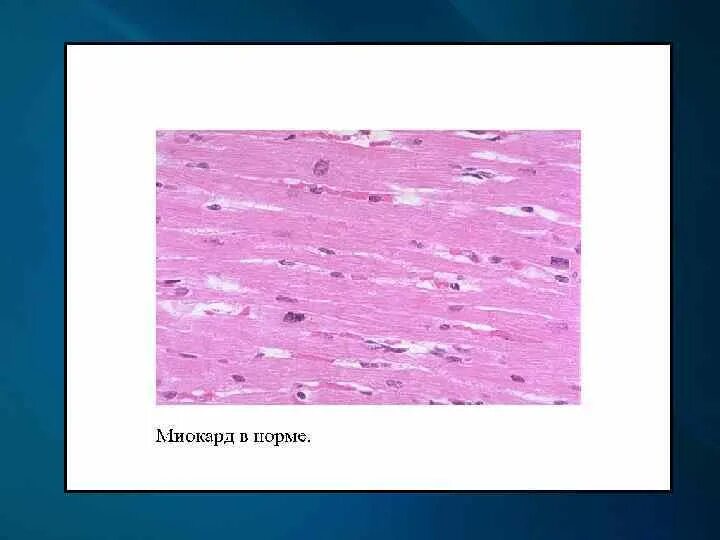 Миокард гистология. Миокард гистология