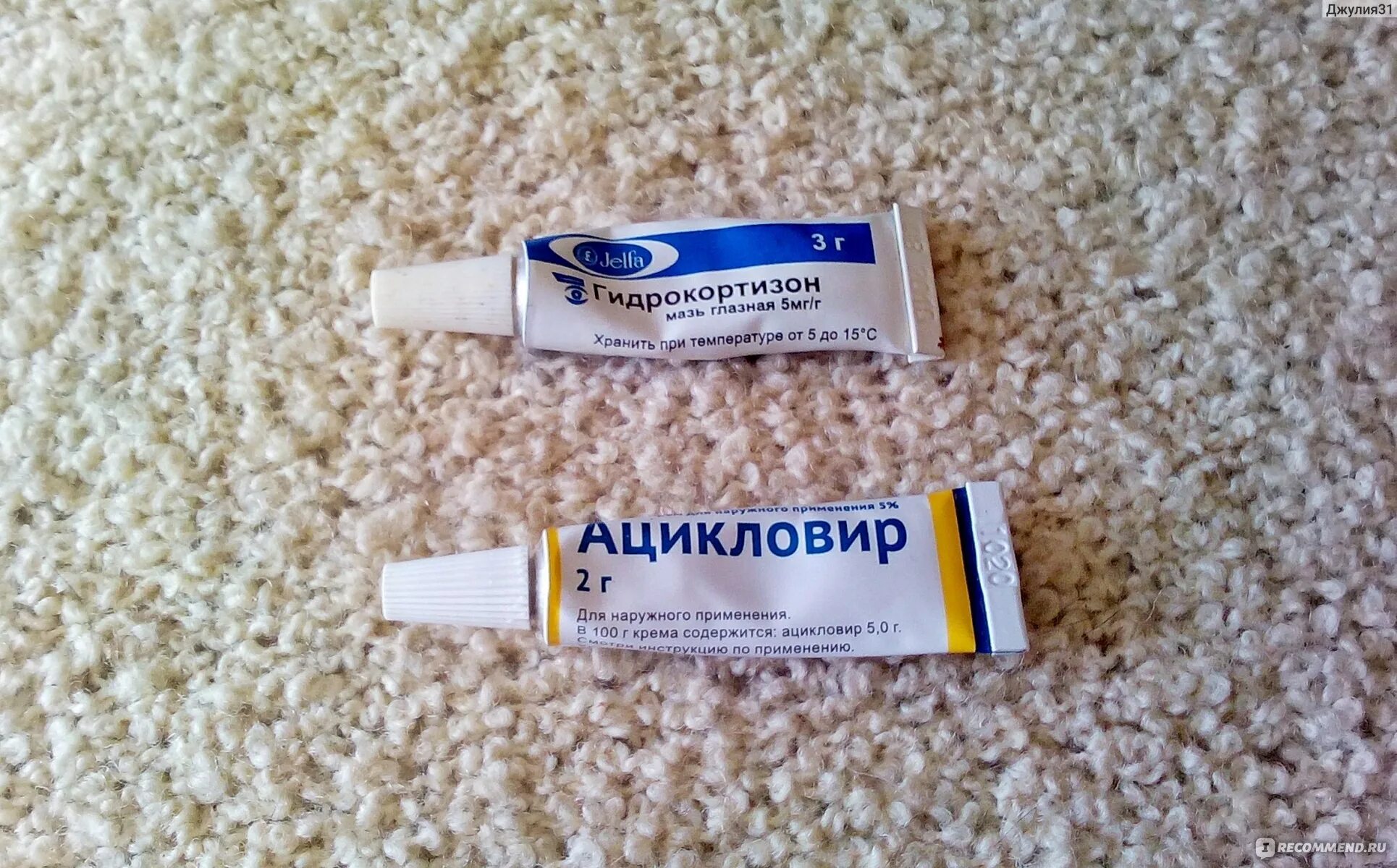 Чем мазать простуду чтобы быстрее прошла