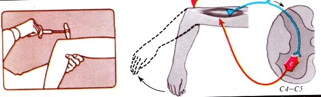Рефлекс плеча. Локтевой сгибательный рефлекс физиология. Локтевой разгибательный рефлекс физиология. Рефлекс трехглавой мышцы плеча схема. Сгибательный рефлекс локоть рефлекторная дуга.