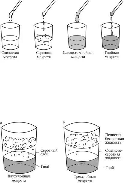 Образование мокроты. Цвет слизисто-гнойной мокроты. Слизисто серозная мокрота. Тип мокроты при пневмонии. Слизисто гнойная мокрота консистенция.