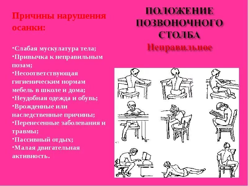 Правило осанки 3 класс окружающий мир. Здоровая осанка. Правила правильной осанки. Зож осанка. Рекомендации для правильной осанки.