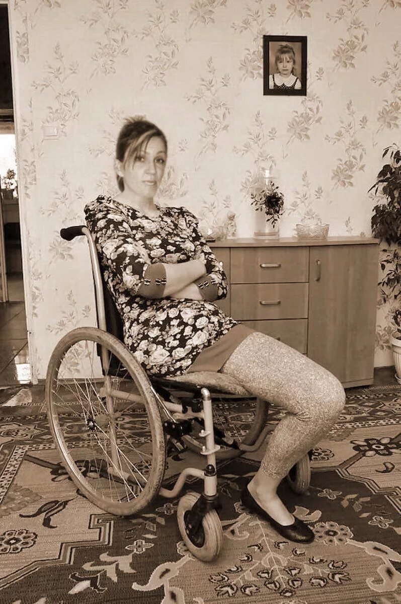 Женщины без конечностей. Инвалидная коляска без ног. Девушка инвалид. Девушка инвалид. Женщина инвалид.