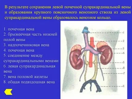Левосторонняя почечная