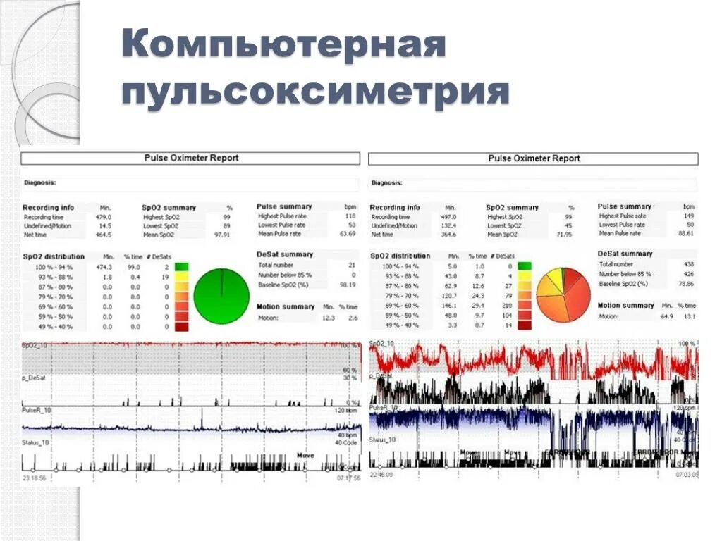 Пульсоксиметрия результаты. Компьютерная пульсоксиметрия. пульсоксиметрия график.