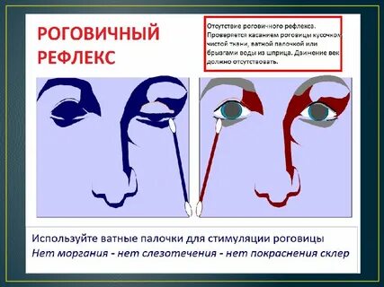 Надбровный