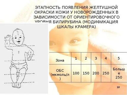 Выписка при желтушке у новорожденных