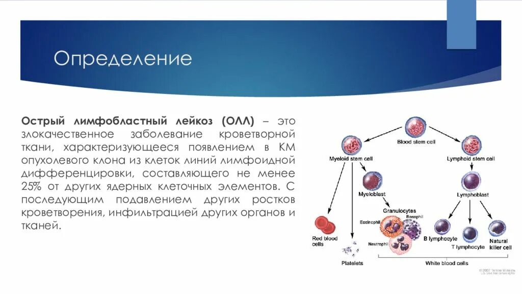 Лимфобластный лейкоз у взрослых. Острый лимфоидный лейкоз патогенез. Патогенез лимфобластного лейкоза. Острый миелоидный лейкоз схема. Острый миелоидный лейкоз схема развития.