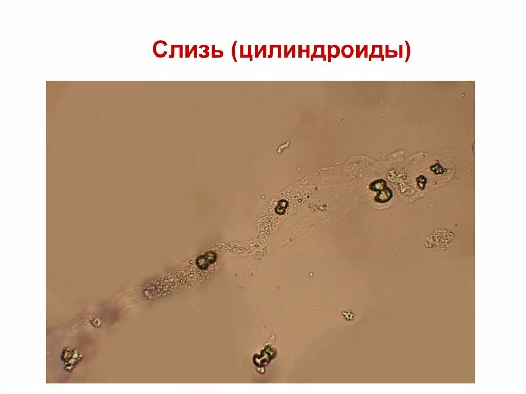 Микроскопия осадка слизь. Микроскопия мочи. Микроскопия мочи бактерии. Микроскопия осадка мочи бактерии.