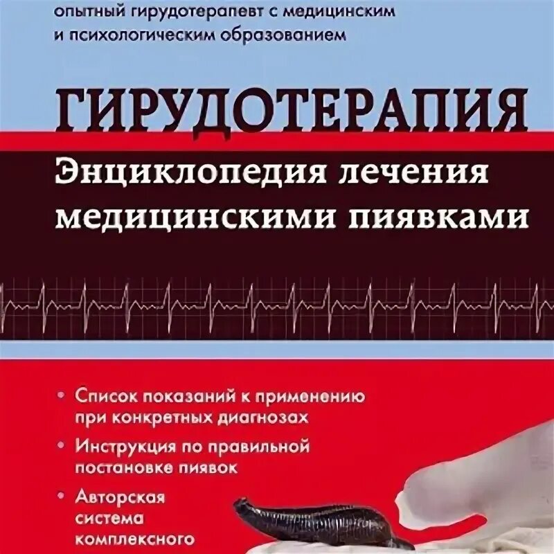 Костикова гирудотерапия. Костикова гирудотерапия. Костикова гирудотерапия. Гирудотерапия наука и практика. Костиков гирудотерапия.