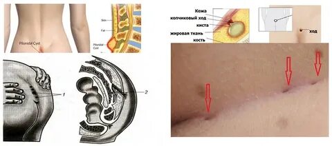 Смотреть онлайн Нона Гришаева порно