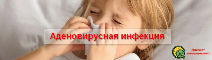 Аденовирус симптомы лечение: найдено 80 изображений