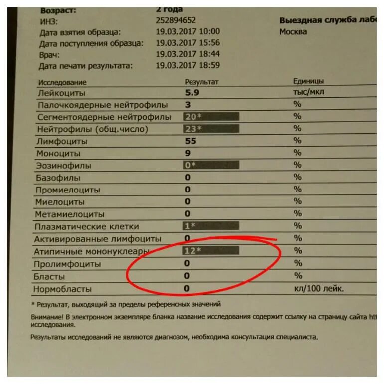 Моноклиоз. Анализ мононуклеоз крови нормы. Мононуклеоз общий анализ крови показатели. Инфекционный мононуклеоз показатели крови. В общем анализе крови при инфекционном мононуклеозе отмечается.