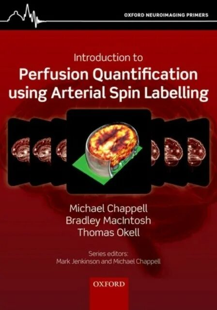 Quantification. Multi-delay pseudo-Continuous arterial Spin labeling forperfusion quantification in the Spleen.