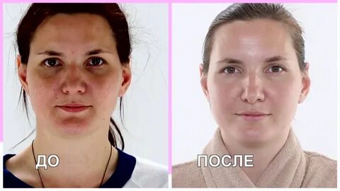 Могут ли дети после удаления