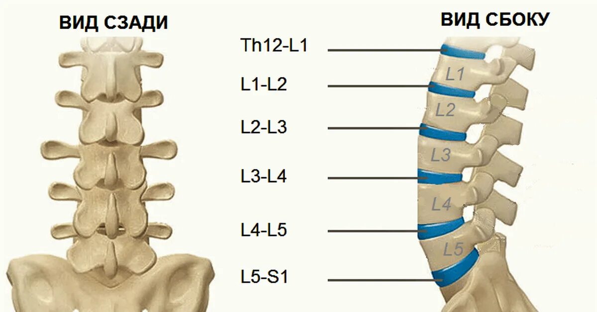 Грыжи дисков позвоночника l3 s1. Диски позвонков l3-l4, l4-l5, l5-s1. межпозвонковые диски l1-l2. межпозвонковые диски l2,l3, l4. диск l1-l2 позвоночника.