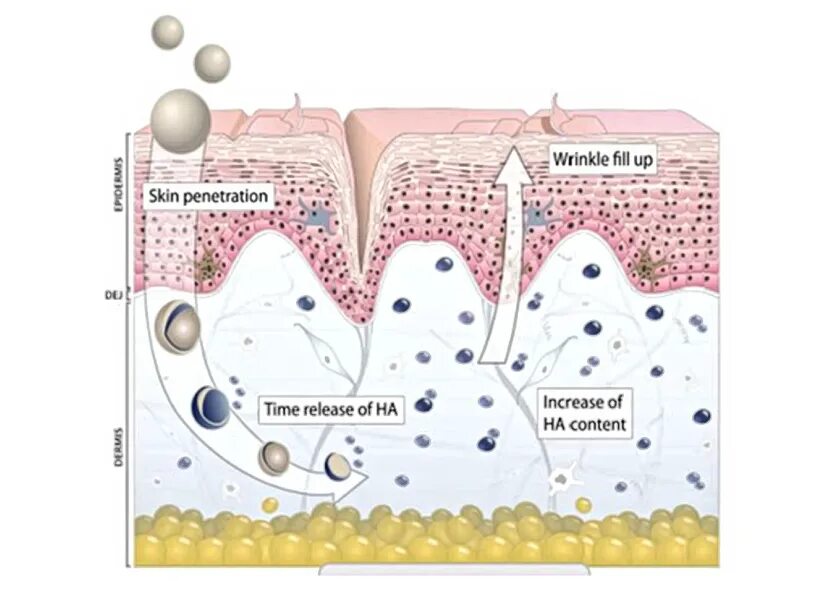 Какие клетки кожи синтезируют гиалуроновую кислоту. Гиалуроновая кислота схема. Высокомолекулярная гиалуроновая кислота. Гиалуроновая кислота в коже.