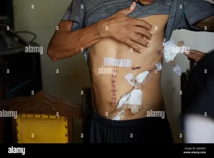 Palm in a medical glove asking for money, the concept of corruption Stock P...