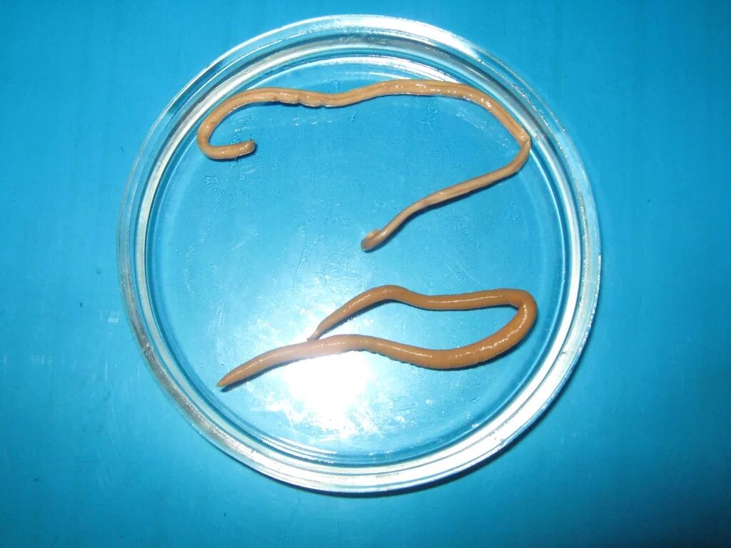 Человеческая аскарида круглый червь. Геогельминтозы (аскаридоз). Паразиты черви аскариды.